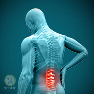 درمان کمر درد با فیزیوتراپی تحت نظارت دکتر رضایی فیزیوتراپیست و متخصص آسیب شناسی ورزشی