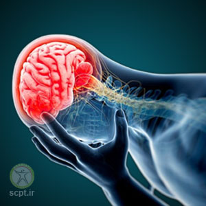 سردرد های میگرنی و شبه میگرنی+تشخیص قطعی درمان موثر