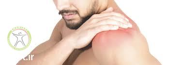 http://scpt.ir/uploads/bankart lesion shoulder pain.jpg