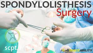 http://scpt.ir/uploads/spondylolisthesis surgery.jpg