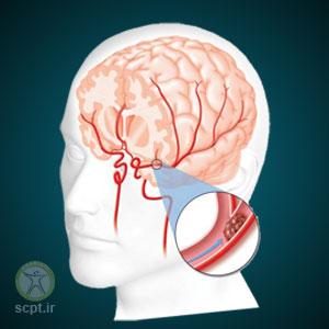 اختلالات-عصب-های-محیطی-و-مرکزی