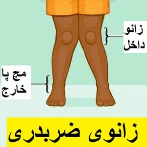 حرکات-اصلاحی-زانوی-ضربدری
