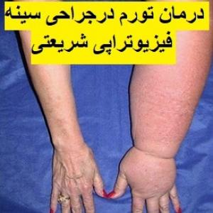 لنفوتراپی-درمان-لنف-ادم-ماساژ-ورم-دست-پا-وازوترین-فیزیوتراپی-شریعتی