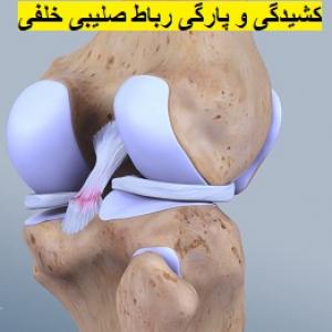 پارگی-رباط-صلیبی-خلفی-PCL-تشخیص-درمان-فیزیوتراپی-کلینیک-شریعتی