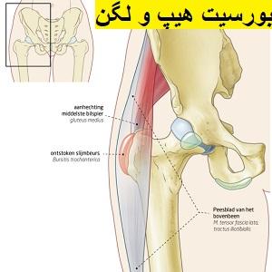 hip-and-pelvic-bursitis