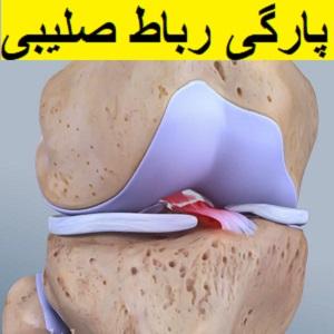 rupture-of-the-cruciate-ligament