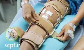 http://scpt.ir/uploads/ACL TEAR reconstruction.jpg