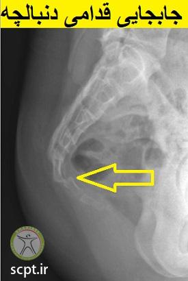 http://scpt.ir/uploads/abnormal-coccyx-xray.jpg