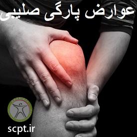 http://scpt.ir/uploads/acl-tear-side-effect.jpg