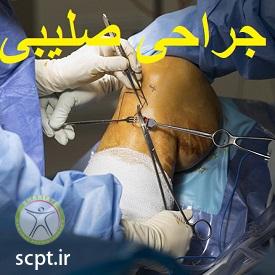 http://scpt.ir/uploads/acl-tear-surgery.jpg