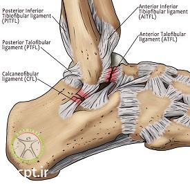 http://scpt.ir/uploads/ankle sparin a2.jpg