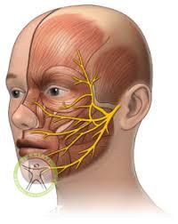 bells balsy shariati seyedkhandan physiotherapy