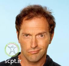 bells balsy shariati seyedkhandan physiotherapy