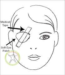 bells balsy shariati seyedkhandan treatment eye protection