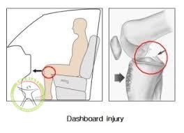 http://scpt.ir/uploads/dashboard-injury.jpg