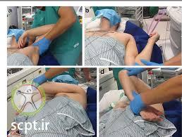 frozen shoulder shariati seyedkhandan 