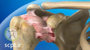 frozen shoulder shariati seyedkhandan 