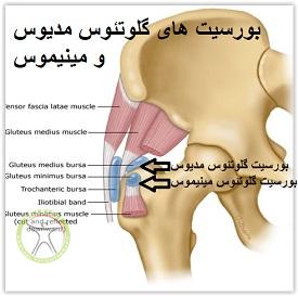 http://scpt.ir/uploads/gluteus-medius-bursitis.jpg