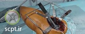 http://scpt.ir/uploads/hip-surgery.jpg