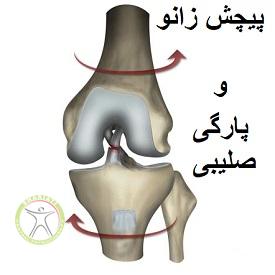 http://scpt.ir/uploads/how-acl-tear.jpg