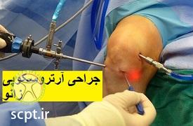 http://scpt.ir/uploads/knee-arthroscopy.jpg