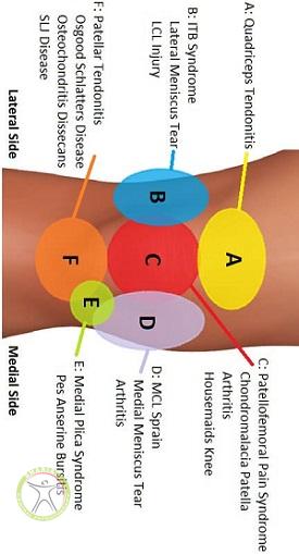 http://scpt.ir/uploads/knee-pain-regions.jpg