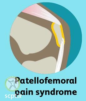 http://scpt.ir/uploads/knee-pain-types-2.jpg