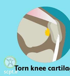http://scpt.ir/uploads/knee-pain-types-4.jpg