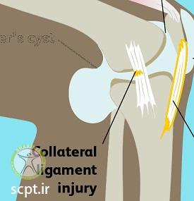 http://scpt.ir/uploads/knee-pain-types-5.jpg