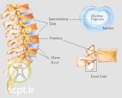 http://scpt.ir/uploads/lumbar anatomy facet.jpg