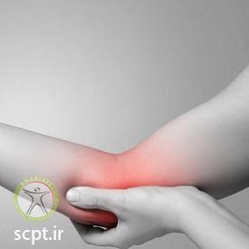 http://scpt.ir/uploads/radial-head-fracture-1.jpg