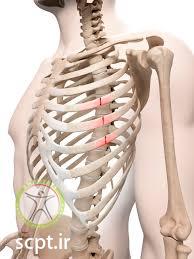 http://scpt.ir/uploads/rib fracture.jpg