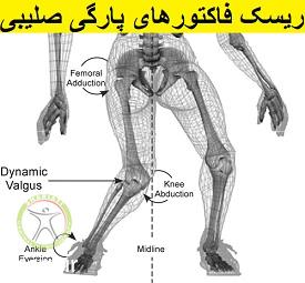 http://scpt.ir/uploads/risk-factor-acl-tear.jpg