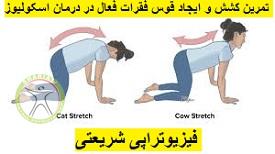 http://scpt.ir/uploads/scoliosis-exercise-2.jpg