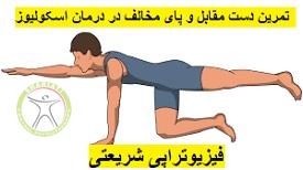 http://scpt.ir/uploads/scoliosis-exercise-3.jpg