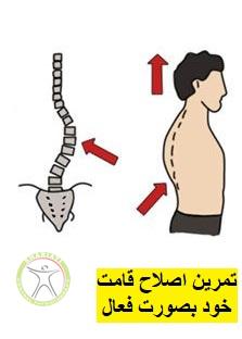 http://scpt.ir/uploads/scoliosis-treatment-3.jpg