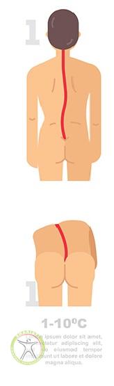 http://scpt.ir/uploads/scoliosis-types-1.jpg