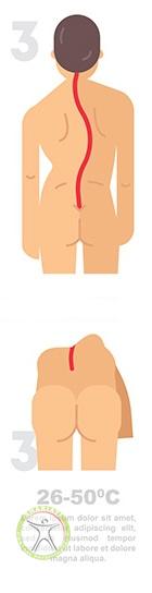 http://scpt.ir/uploads/scoliosis-types-3.jpg