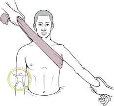 http://scpt.ir/uploads/shoulder dislocation reduction.jpg