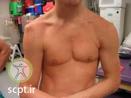 http://scpt.ir/uploads/shoulder dislocation.jpg