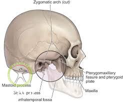 http://scpt.ir/uploads/temporomandibular joint 1.jpg