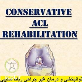 http://scpt.ir/uploads/treatment-of-cruciate-ligament-rupture-without-surgery.jpg