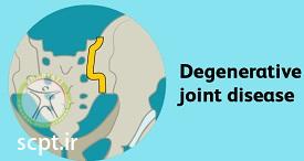 http://scpt.ir/uploads/treatment-of-tailbone-pain-causes-DJD.jpg