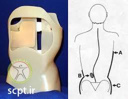 http://scpt.ir/uploads/under-arm-brace.jpg
