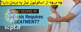 http://scpt.ir/uploads/what-degree-scoliosis-need-treatment.jpg