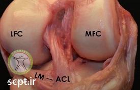 http://scpt.ir/uploads/whats-ligament-acl.jpg